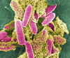 e coli